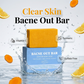 🔥Buy 2 Get 1 Free ✨Body Acne Soap for Clearer Skin