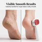 ✨Double-Sided Foot Scraper for Callus Removal