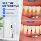 📢📢50% OFF !! ⏰Portable Ultrasonic Teeth Cleaner and Tartar Remover Set